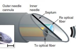 TECH: Researchers Create A New Optical Ultrasound Needle Meant For (Internal) Surgical Images Optical Ultrasound Needle