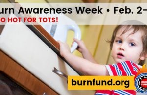 Burn Awareness Week to highlight top burn hazards for young children